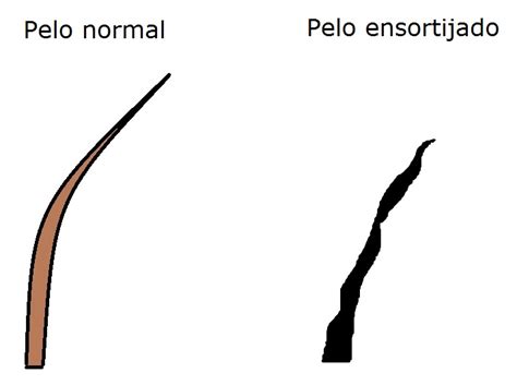 pelo ensortijado causas|Cabello ensortijado: causas, cuidado y cómo mejorarlo